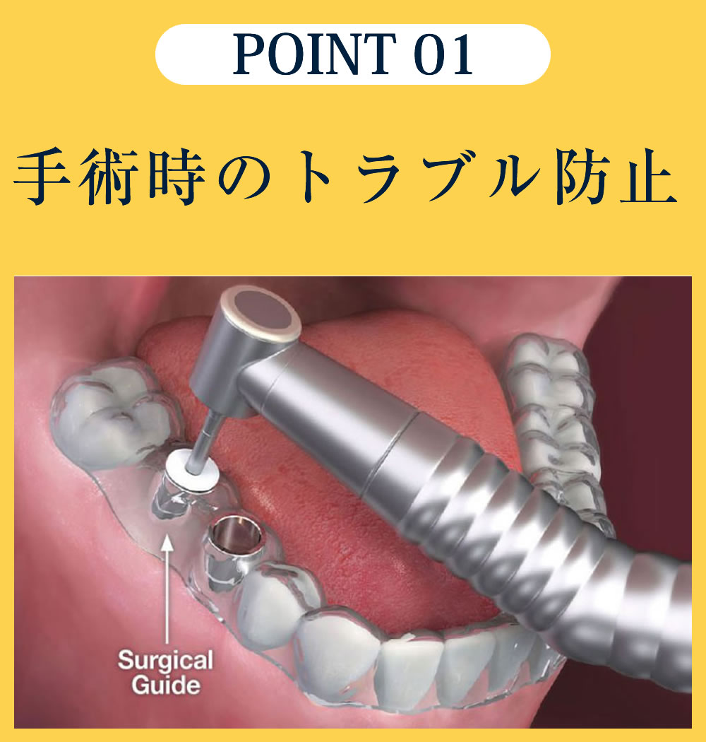 手術時のトラブル防止