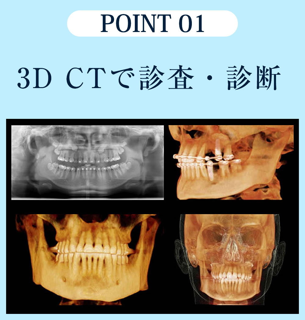 CT精密検査