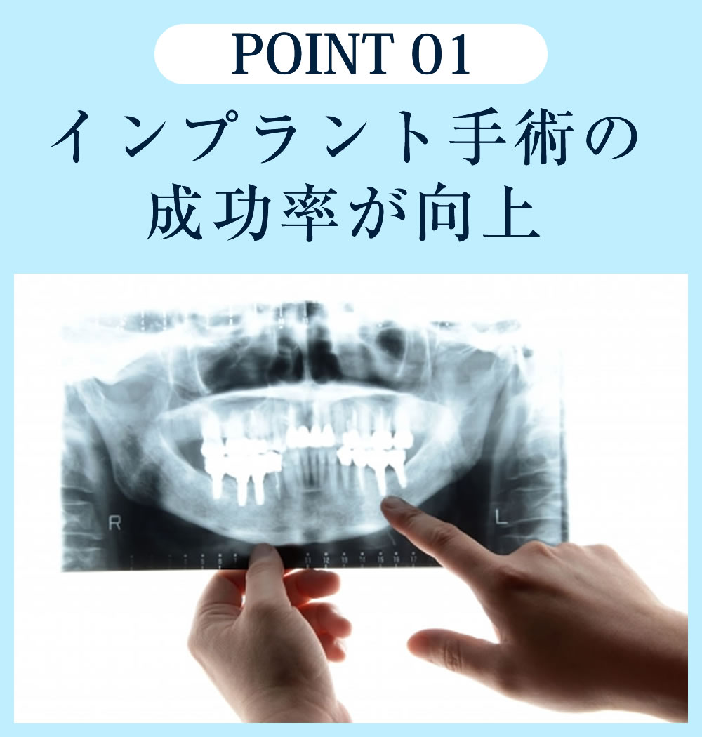 インプラント手術の成功率が向上